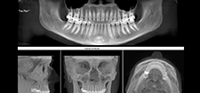 رادیوگرافی دهان و دندان دانشکده دندانپزشکی