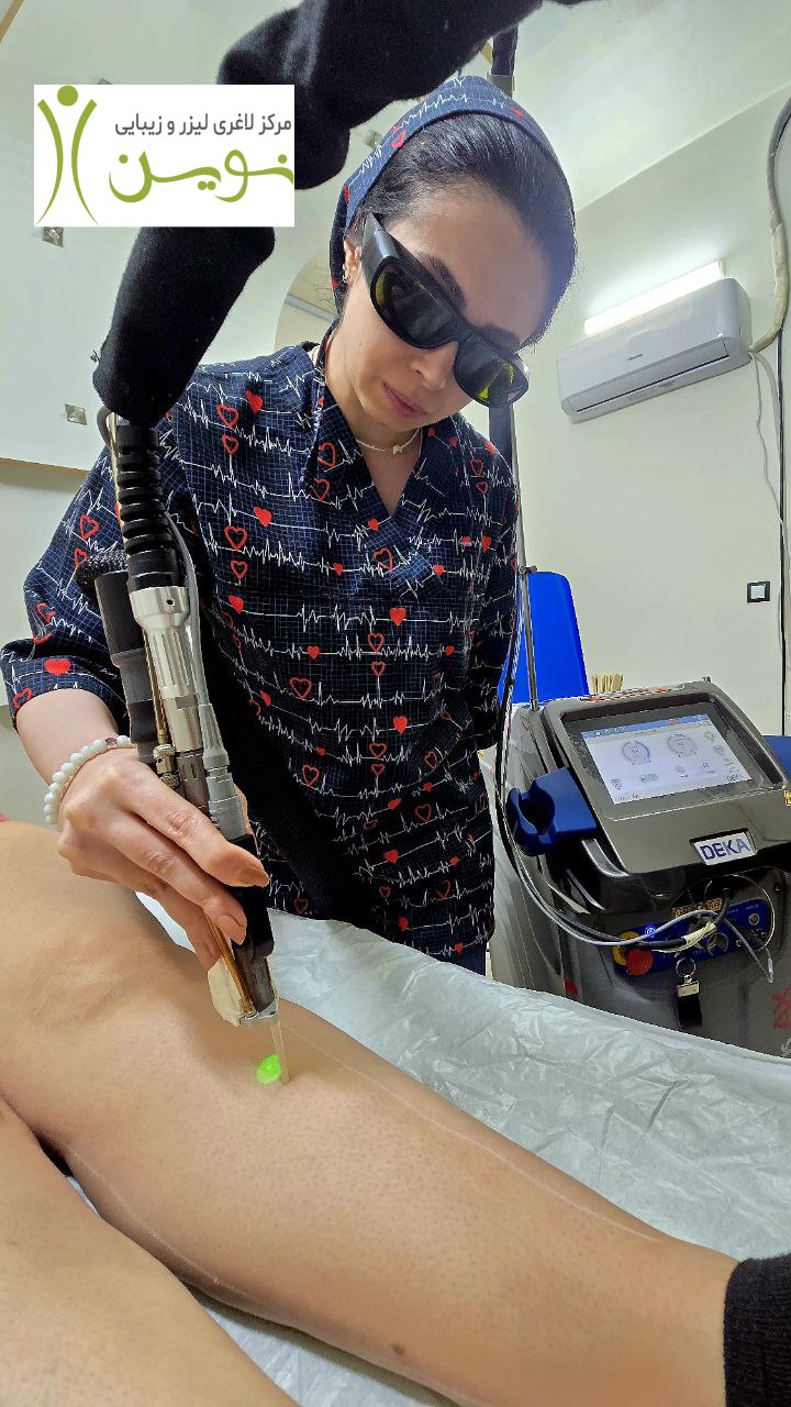 لیزر موهای زائد در اصفهان